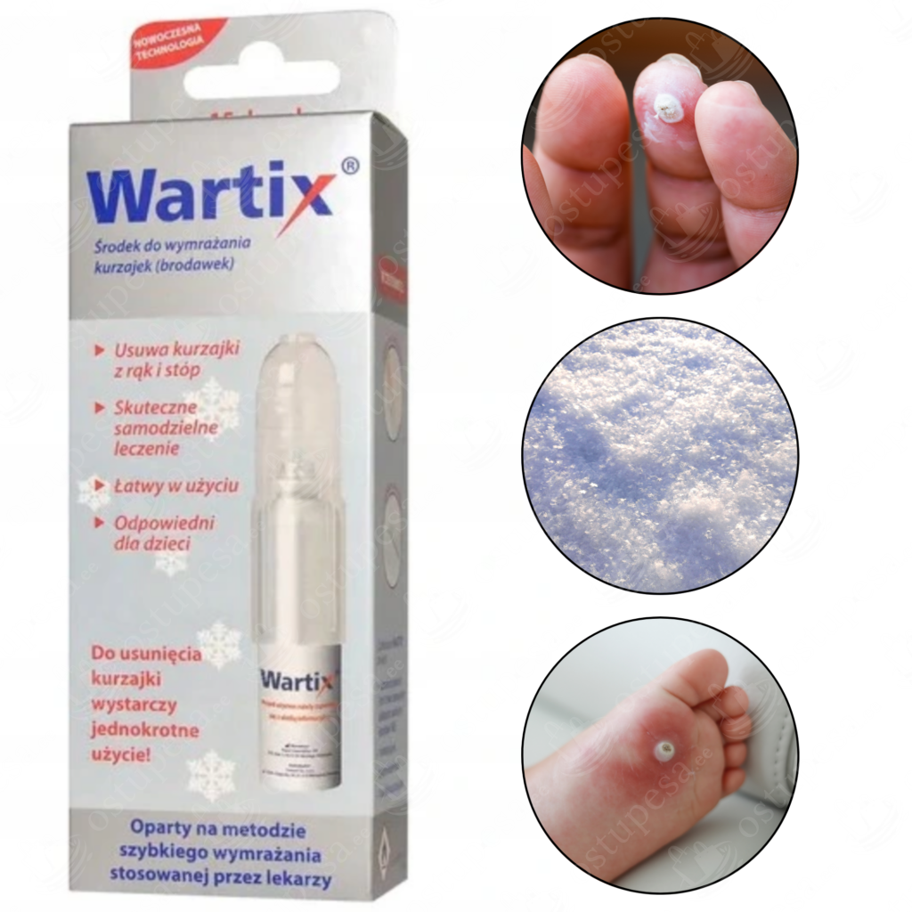 Soolatüügaste eemaldaja, 38ml, Wartix