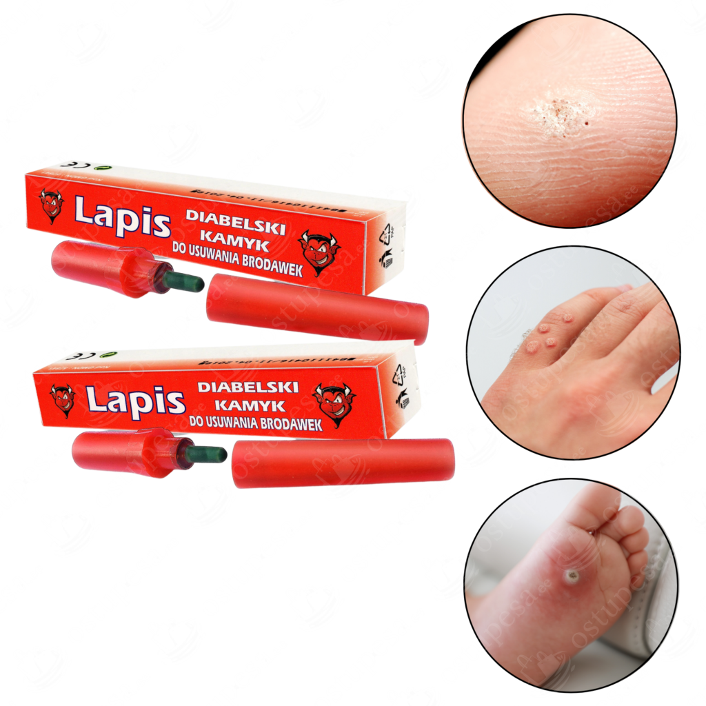 Tüügaste eemaldamiseks mõeldud pulk, Lapis