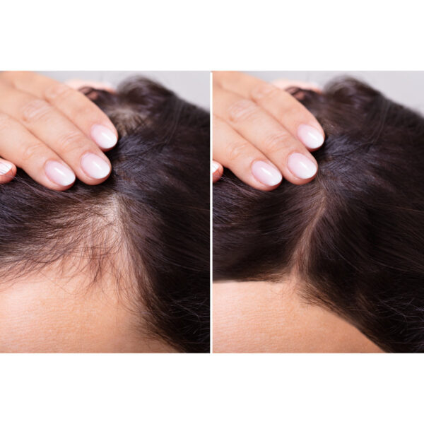 Juuste väljalangemise vastane šampoon, Ronney, 1L