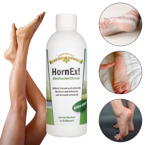 Nahapaksendite ja küünenahkade eemaldaja, HornEx, 250 ml