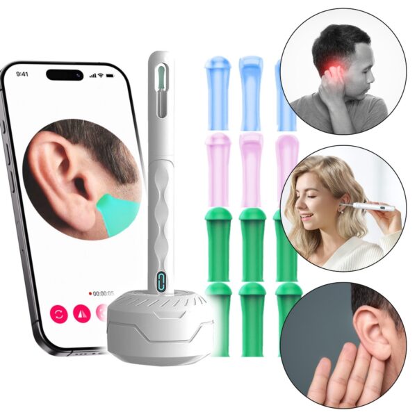 Otoskoop kaameraga, Renew Force