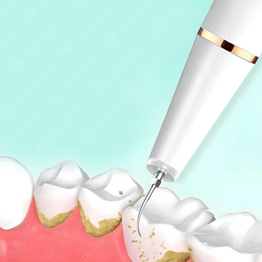 Ultraheli hambapuhastusseade LED-valgustusega